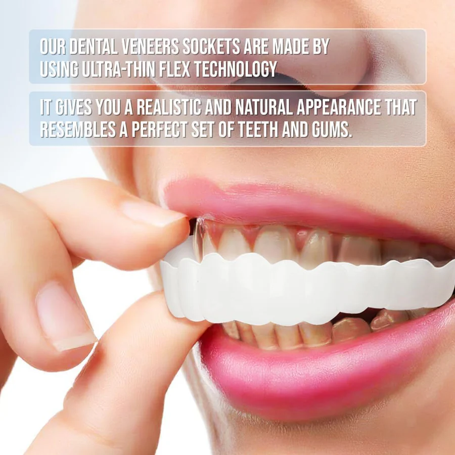Full Dental Veneer Kit – Upper & Lower Cosmetic Covers