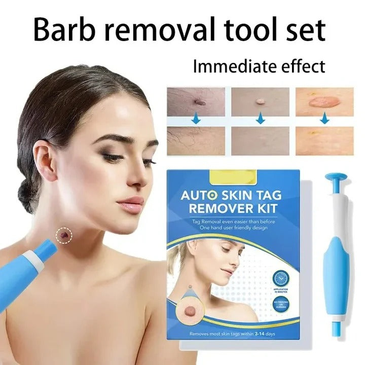 Skin Tag Removal Kit with Silicone Bands & Pen Band Tool