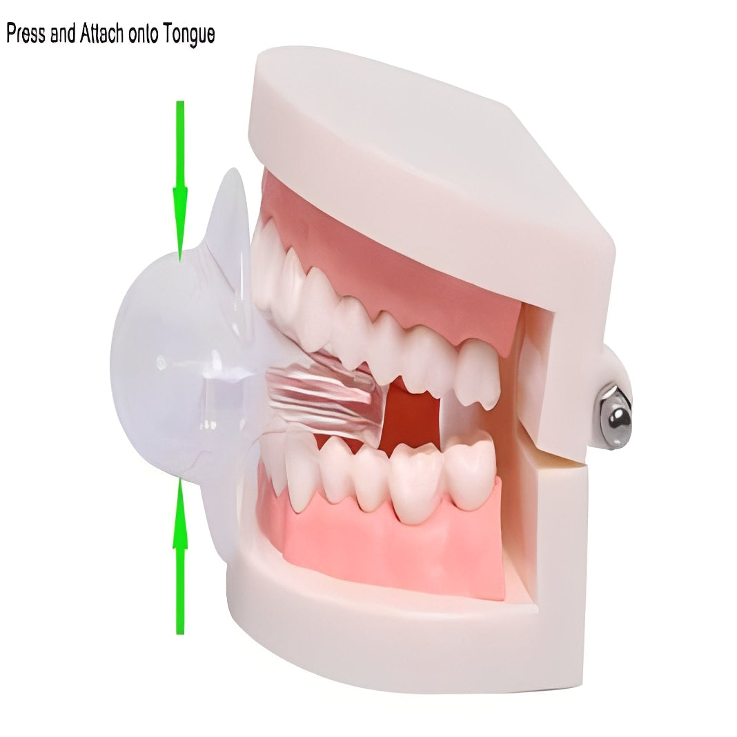 Tongue Positioning Device for Sleep Airflow Support