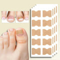 Ingrown Nail Correction Tool with Instant Repair Treatment