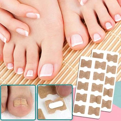 Ingrown Nail Correction Tool with Instant Repair Treatment