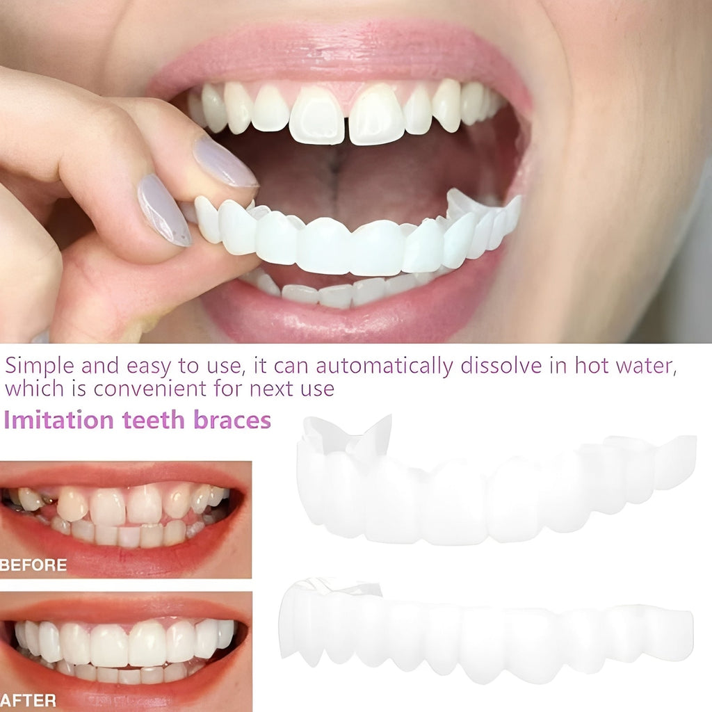 Snap On Cosmetic Tooth Covers for Adults, 2 Piece Set